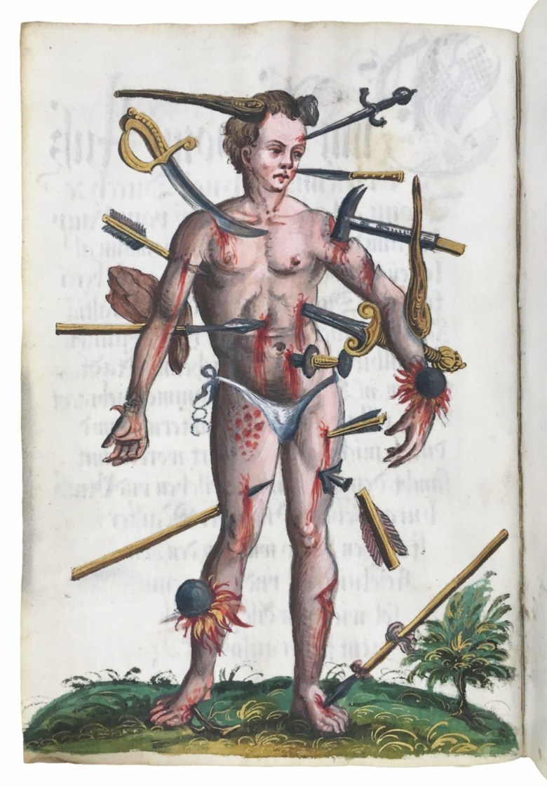 Sebastian Jäger，“Wound Man” (c. 1580)，ink and paint on parchment，painted in Vienna，Austria，held in UCLA’s Louise M. Darling Medical Library，MS Benjamin 8，fol. IVv (photo by Jack Hartnell) 塞巴斯蒂安·耶格尔，“伤者”（约 1580 年），墨水和颜料，羊皮纸，维也纳，奥地利绘制，收藏于加州大学洛杉矶分校露易丝·M·达林医学图书馆，MS Benjamin 8，fol. IVv（杰克·哈特内尔 摄）